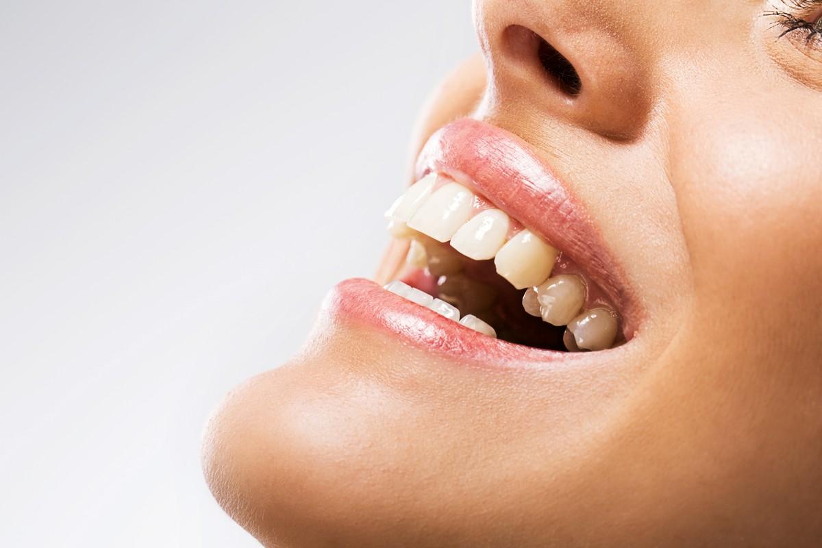 Wybielanie zębów a stan szkliwa